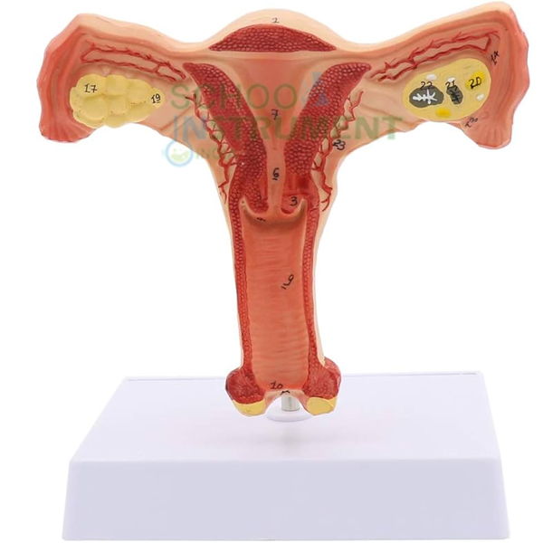 Human Model - Uterus, on Stand