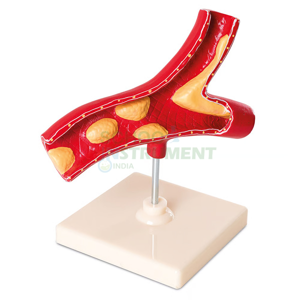 Human Lymph Node