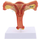 Human Model - Uterus, on Stand